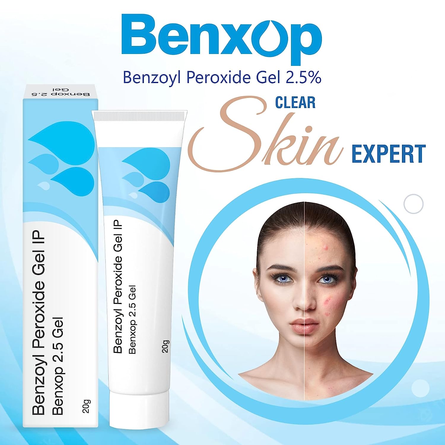 Salve Benxop Benzoyl Peroxide 2.5% Pimples Cream - 20 GM (0.70 Oz) | Effective Acne Treatment