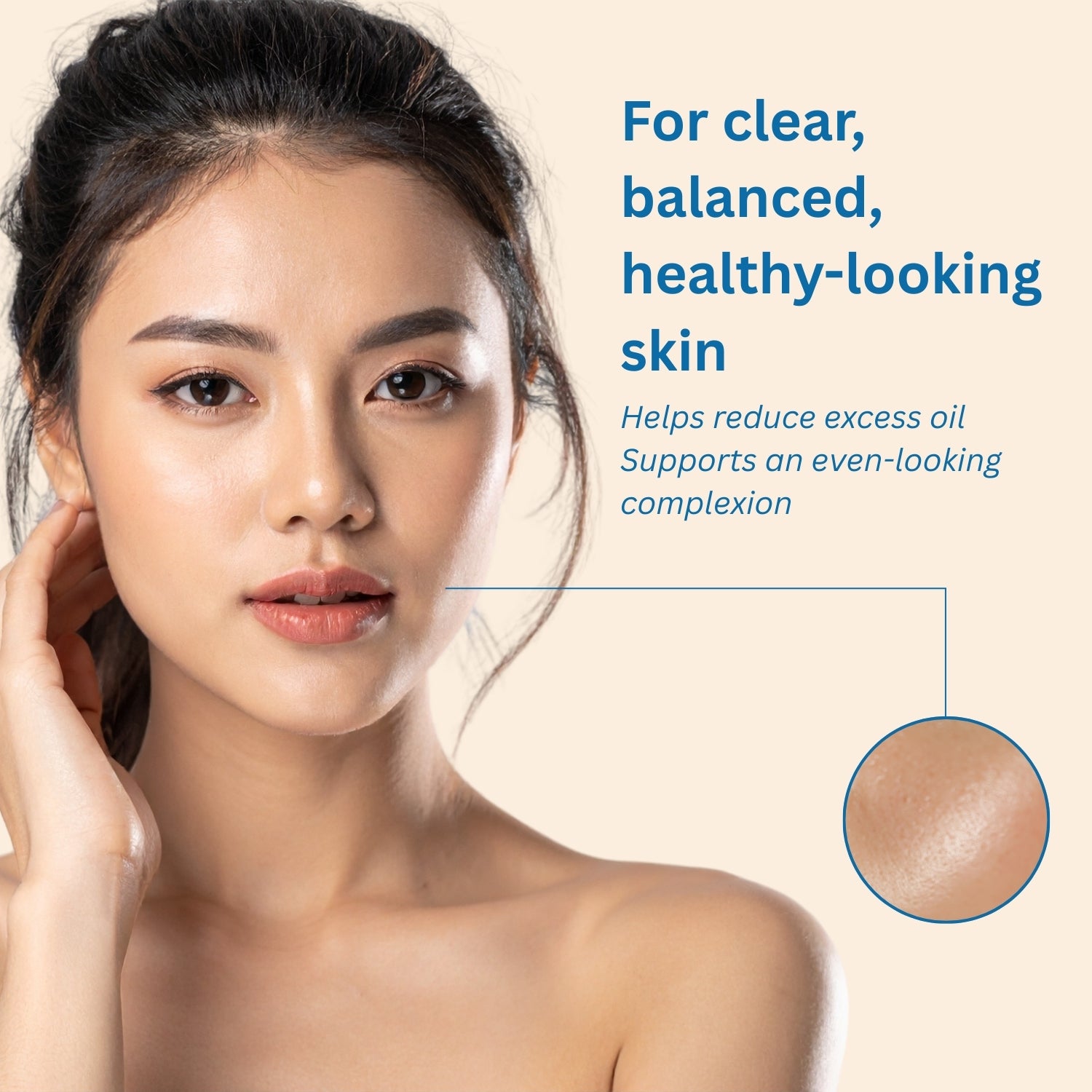 Benxop Acne Gel 2.5% - 6 Pack