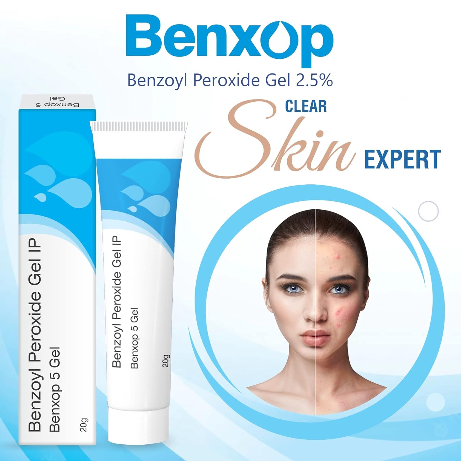 Benxop Benzoyl Peroxide 5% Pimples Cream - 20 GM (0.70 Fl Oz) | Powerful Acne Treatment