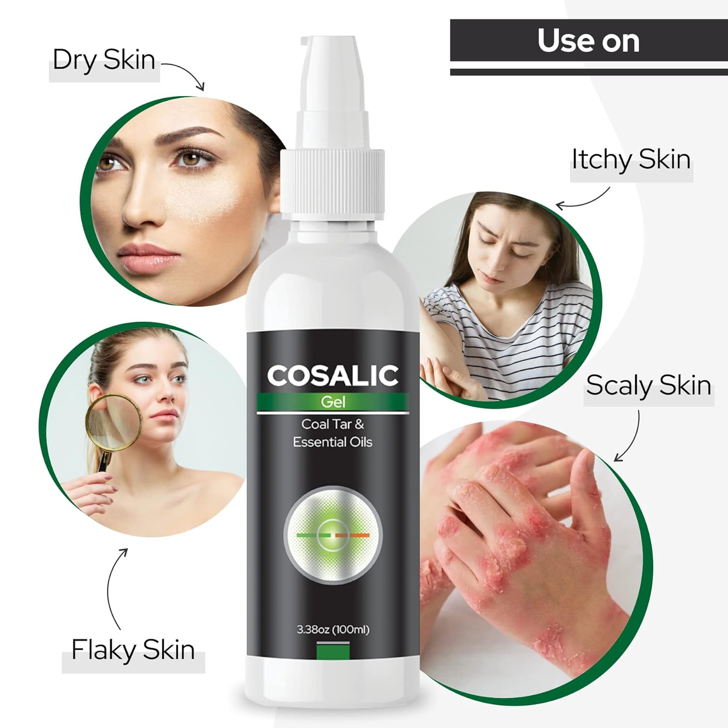 Salve Cosalic Gel - 100 ml (3.38 Oz) | Relieves Dry, Flaky, Scaly, Itchy Skin | Enriched with Essential Oils & Coal Tar | Suitable for All Skin Types